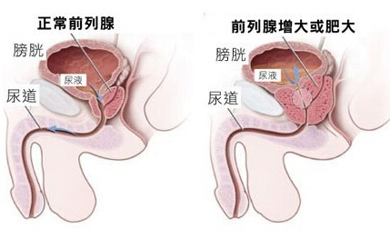 前列腺有啥症状,前列腺健康与症状解析，创新执行设计解析_AP78.64.30视角,高效设计策略_免费版62.69.51